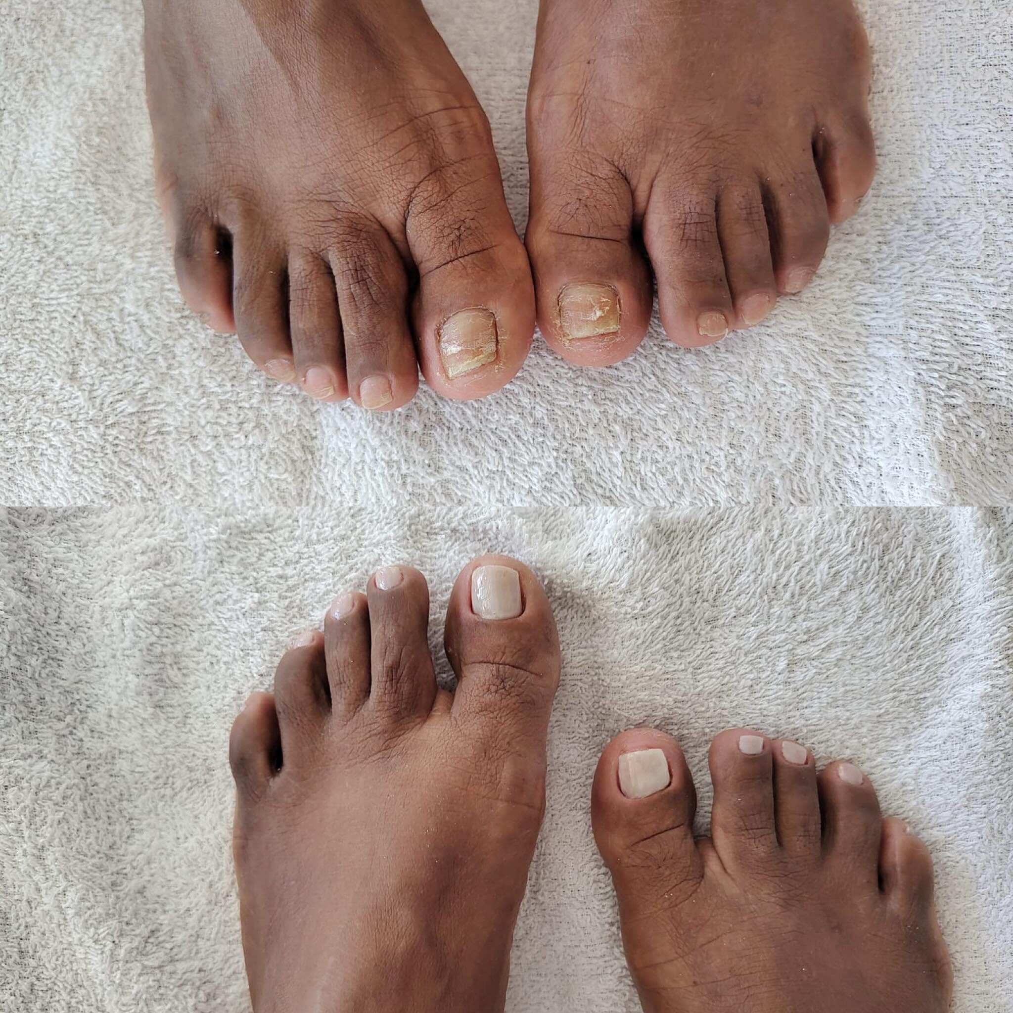 SPA dos pés em Ilhabela - A Bela da Ilha SPA dos pés em Ilhabela - A Bela da Ilha
