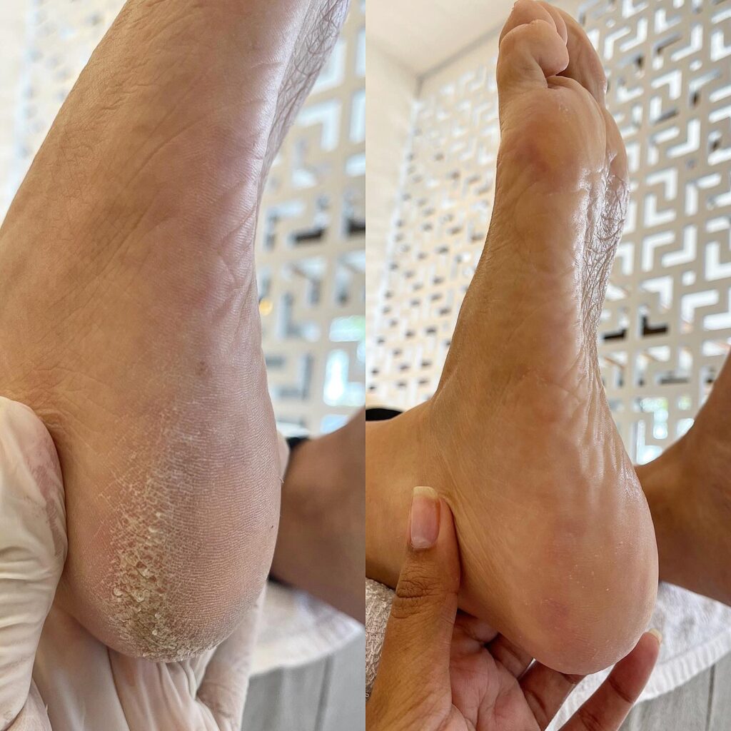 Estética corporal – A Bela da Ilha, Perequê, Ilhabela - SP – foto 7